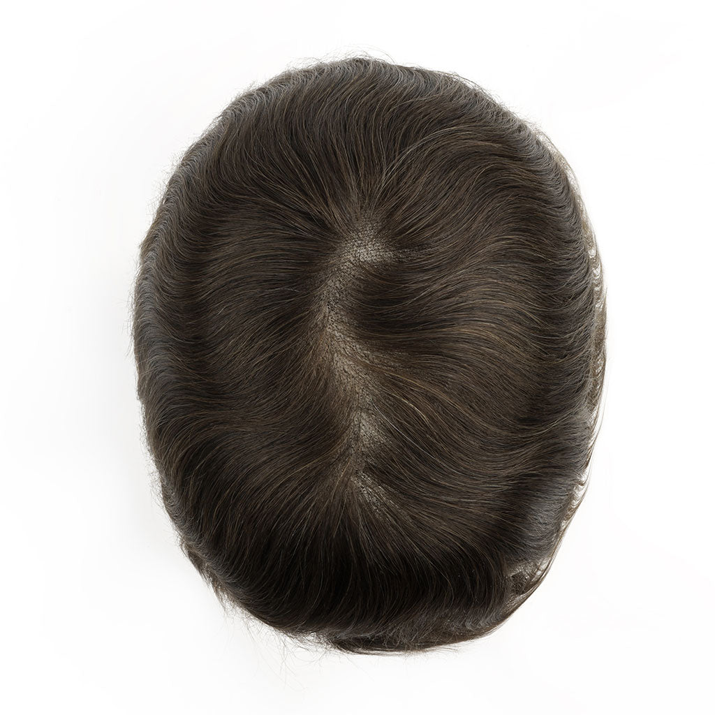 Top view showing natural hairline