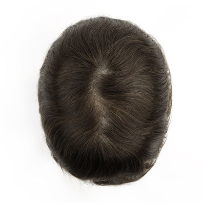 Top view showing natural hairline