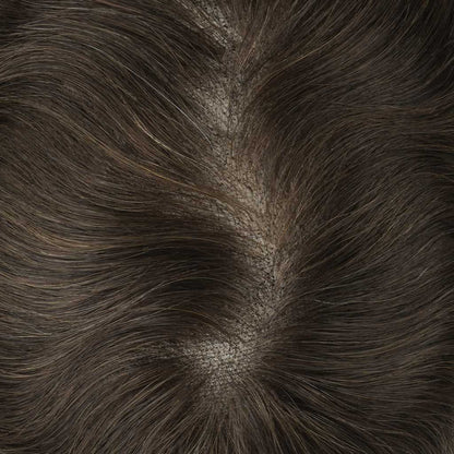 Close-up view of natural hairline